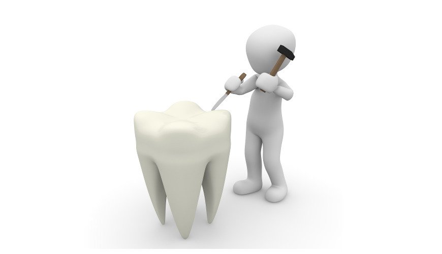prevence zubních kazů